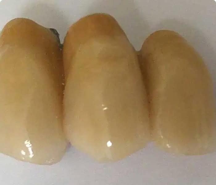 Img-srv-Protesi-fissa